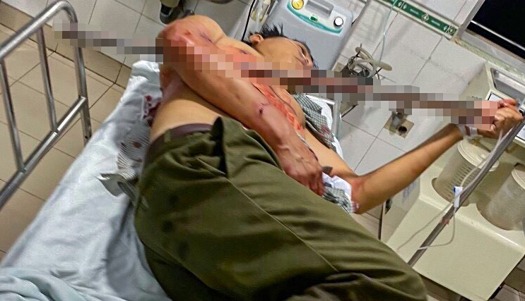 To truong dan phong bi thuong khi ngan chan hon chien hinh anh