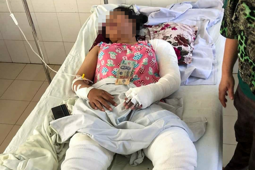 Me ke tam xang dot ca nha, 4 nguoi bi thuong hinh anh