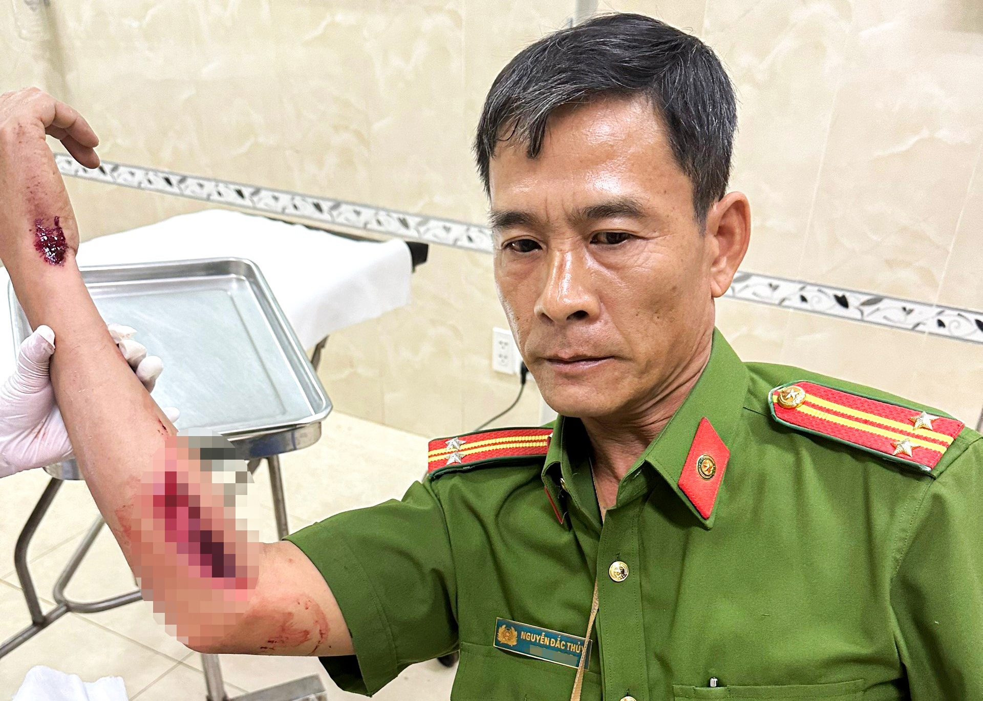 Trung ta cong an bi nguoi vi pham nong do con tong nhap vien hinh anh