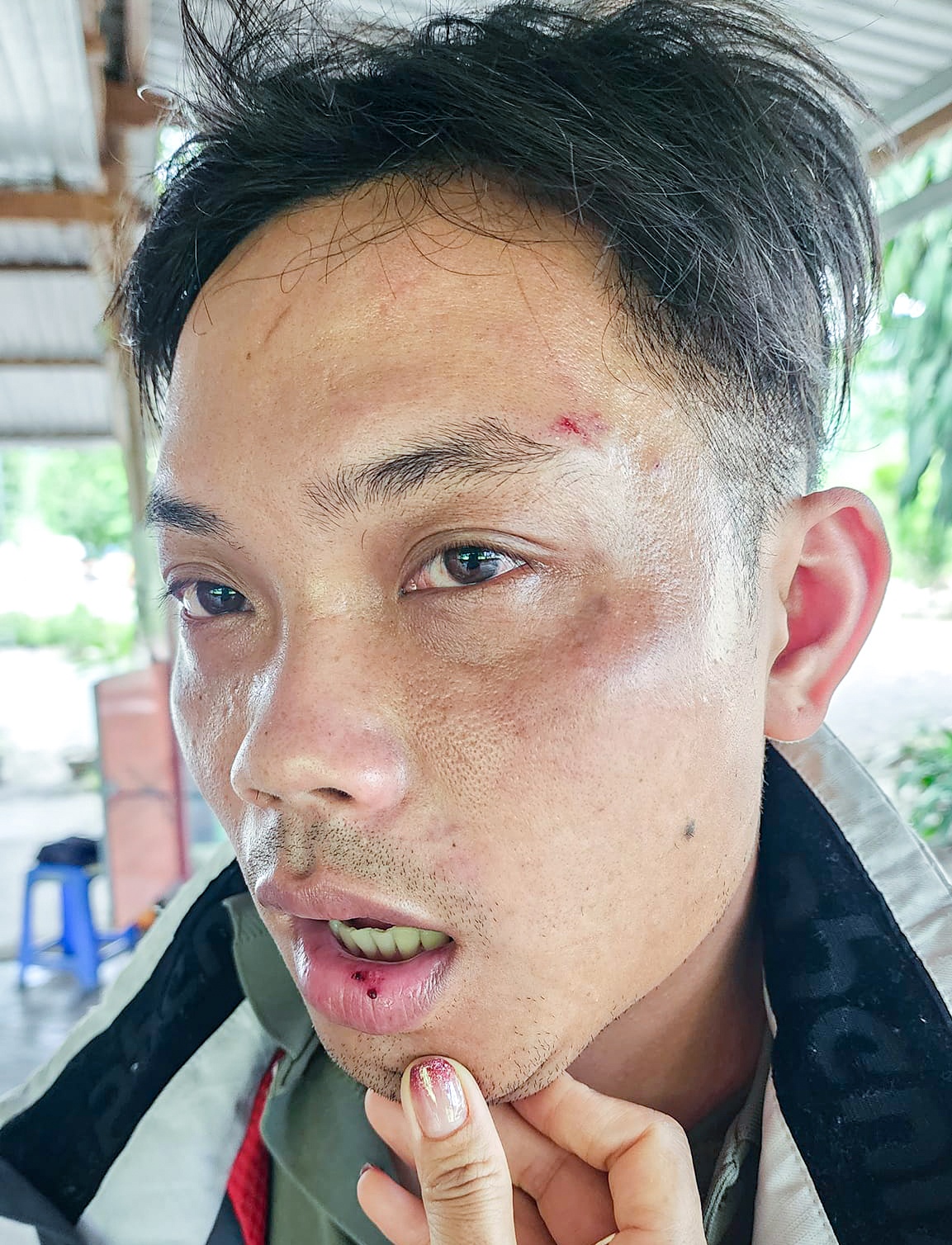 du khach bi danh anh 1