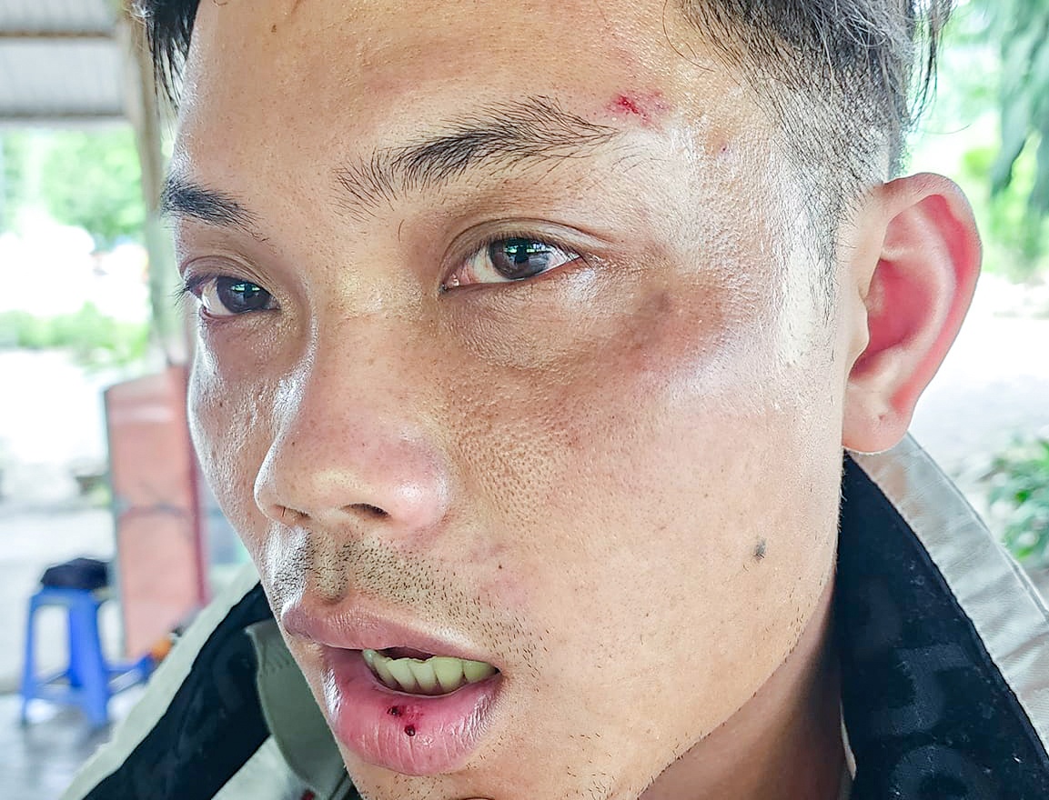 Lam viec voi nhom thanh nien bi to danh du khach o Nha Trang hinh anh