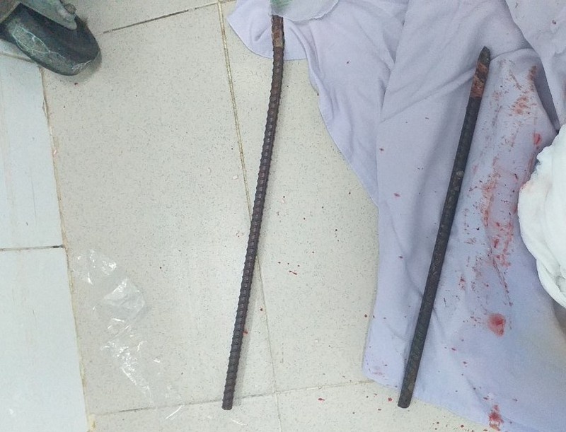 thanh sat dam xuyen nguoi anh 1