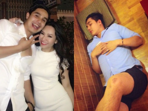 Hau dam cuoi, Baggio say bi ti 2 dem hinh anh