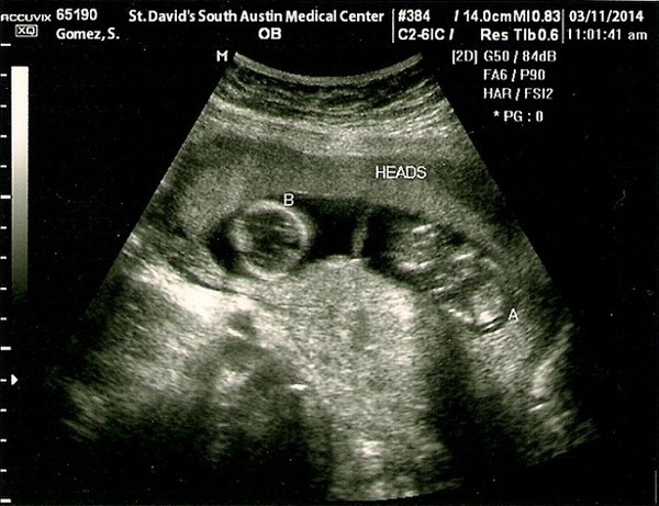 Selena va Justin bi tung anh sieu am song thai gia hinh anh