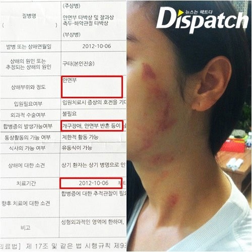 Hình ảnh vợ cũ của Lee Sung Wook và những vết bầm tím do anh gây ra.