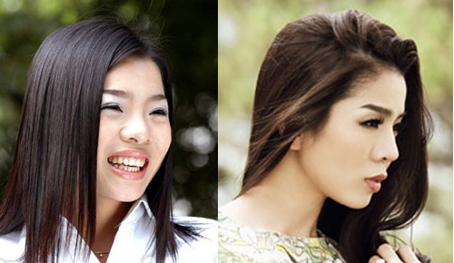 Sự khác biệt khá rõ của Lệ Quyên ngày ấy và bây giờ.