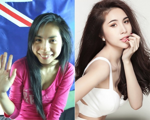 Trước khi có được nhan sắc quyến rũ như ngày hôm nay, Thủy Tiên cũng từng có thời làm “vịt con xấu xí” với phần đầu mũi khá to, sống mũi tuy cao nhưng thô. Trong dịp tu sửa lại gương mặt, nữ ca sĩ cũng dao kéo lại chiếc mũi kém xinh này khiến nó trở nên thon gọn, cân đối.