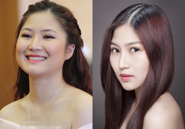 Nghi án quán quân Giọng hát Việt Hương Tràm nâng mũi đã có từ lâu nhưng chỉ mới đây, Hương Tràm mới thừa nhận. Một đoạn clip ghi lại hình ảnh Hương Tràm nằm trên bàn mổ trong phòng phẫu thuật bị phát tán lên mạng, ngay sau đó nữ ca sĩ trẻ đã giải thích lý do làm đẹp bằng dao kéo. Cô cho biết mình đã đi thẩm mỹ mũi.