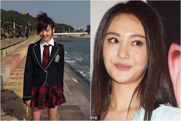  Trịnh Sảng thời đóng BOF bản Trung và sau khi đã can thiệp dao kéo.