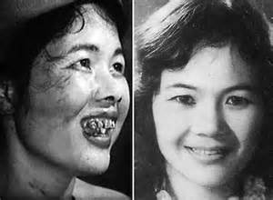 NSƯT Đức Lưu trong vai Thị Nở.