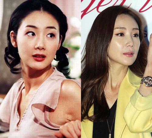 Gương mặt của Choi Ji Woo thon nhỏ kỳ lạ.