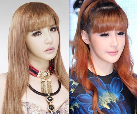 Park Boom là một trong những trường hợp đáng tiếc nhất vì lạm dụng thẩm mỹ.