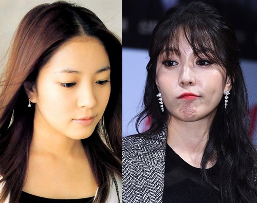 BoA mất đi vẻ đẹp trong sáng. Thay vào đó là muôn khuôn mặt căng bóng, không một nếp nhăn vô cùng gượng gạo.