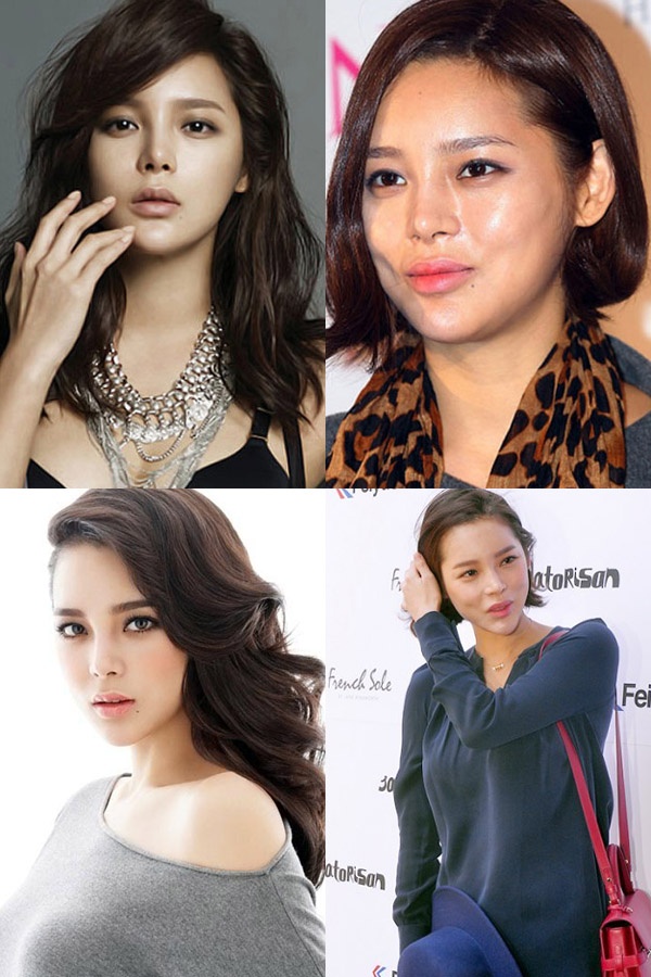 Park Shi Yeon là một trong những mỹ nhân đẹp lên nhờ dao kéo. Tuy nhiên, việc lạm dụng phẫu thuật thẩm mỹ đã khiến gương mặt cô trở nên méo mó.