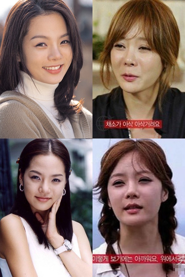 Chae Rim - nữ diễn viên xinh đẹp thưở nào nay trở thành