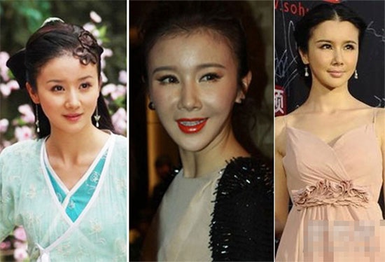 Nhiều người phải tiếc nuối cho nhan sắc tự nhiên và dễ thương một thời của Tôn Phi Phi.