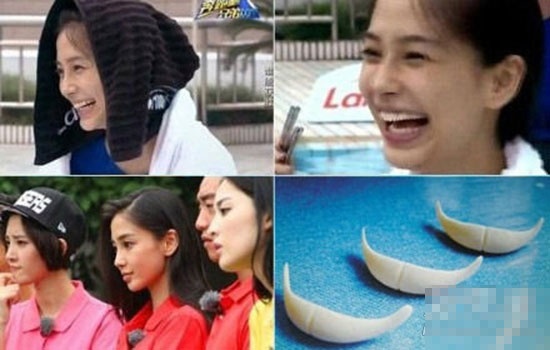 Dù không thừa nhận thẩm mỹ nhưng Angela Baby nhiều lần lộ mặt cứng và miếng độn cằm.