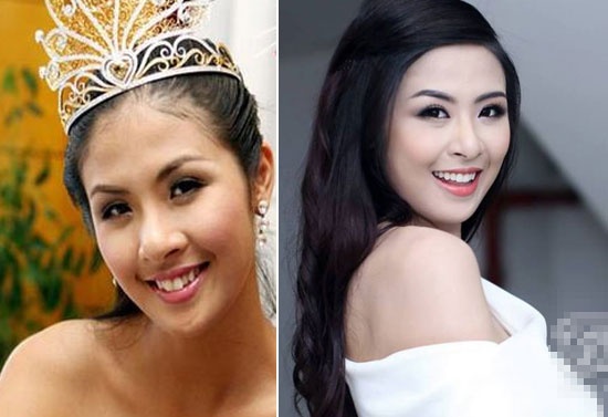 7 my nhan Viet tu sua ham rang that hinh anh