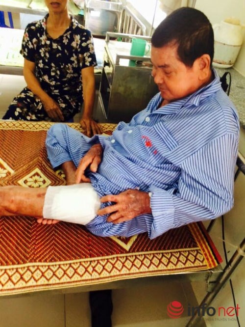 Ông Đ. và vết thương ở đùi vì cái nhọt.