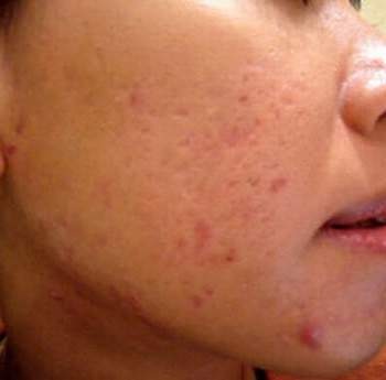 Chuyen cac 'bac' hinh anh