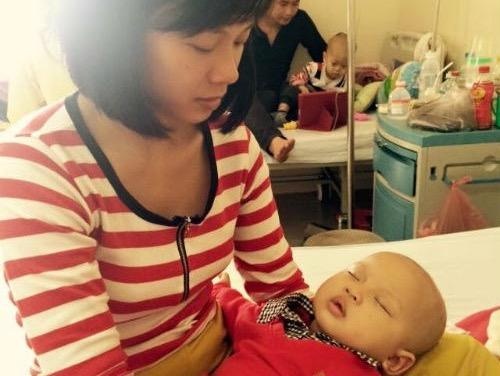 Phat hien ung thu da cua con tu cai nhot hinh anh