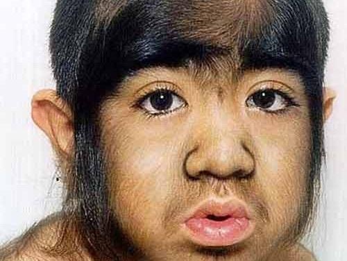 Nhung can benh ky la nhung co thuc hinh anh