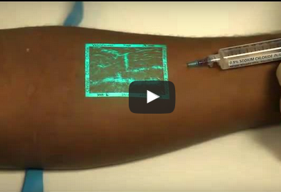 VeinViewer giup hien thi ven tren be mat da hinh anh