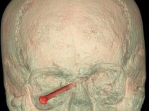 Nhung ca benh khien bac si phat hoang hinh anh