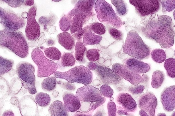 Nguy hiem: Loai benh moi lay truyen qua duong tinh duc hinh anh