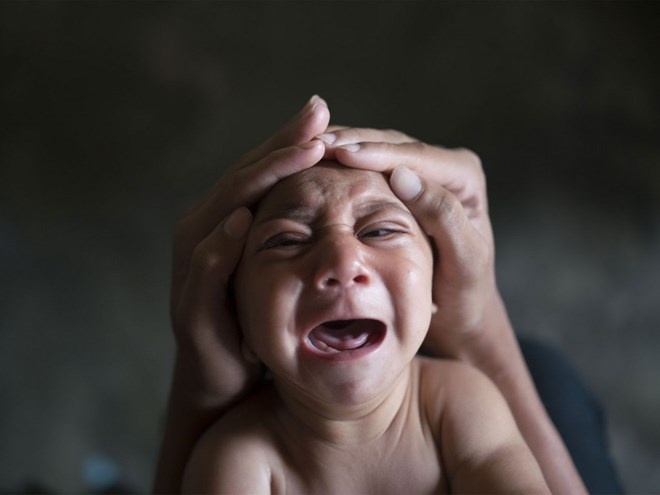 Cach phong tranh nhiem virus Zika hinh anh