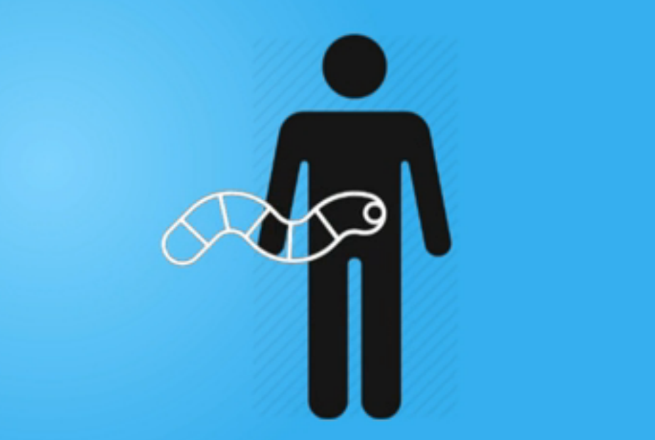 Giun san tan pha co the nhu the nao? hinh anh