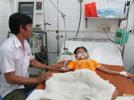 nguy cơ bại não  ảnh 1 nguy co bai nao anh 1