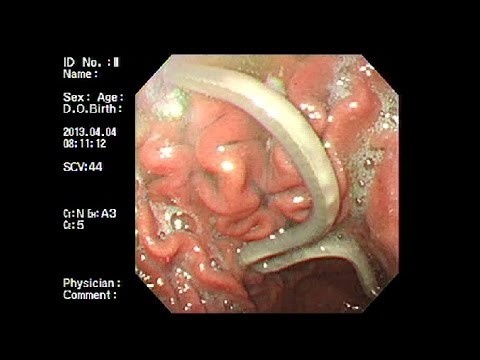 Con vat dang so o ruot non 95% nguoi Viet hinh anh