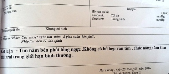 tim ở bên ngực phải  ảnh 1 tim o ben nguc phai anh 1
