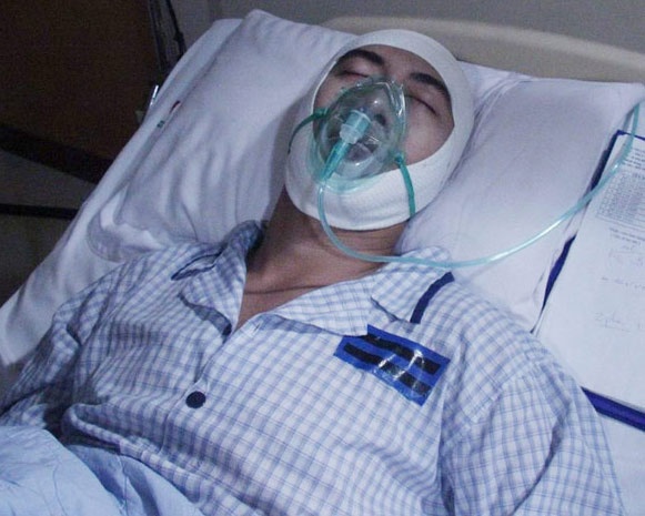 Tac gia 'Anh khong doi qua' gap tai nan nguy kich tren phim hinh anh