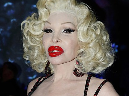 Nhung bien dang hau dao keo dang so cua sao hinh anh