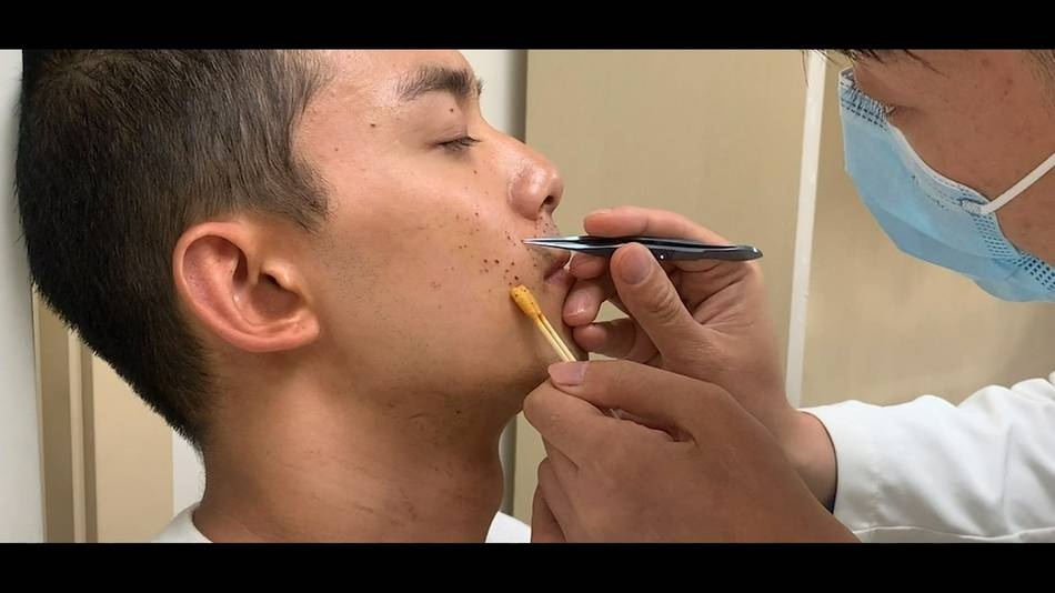 Ngo Loi bi thuong tren phim truong anh 1