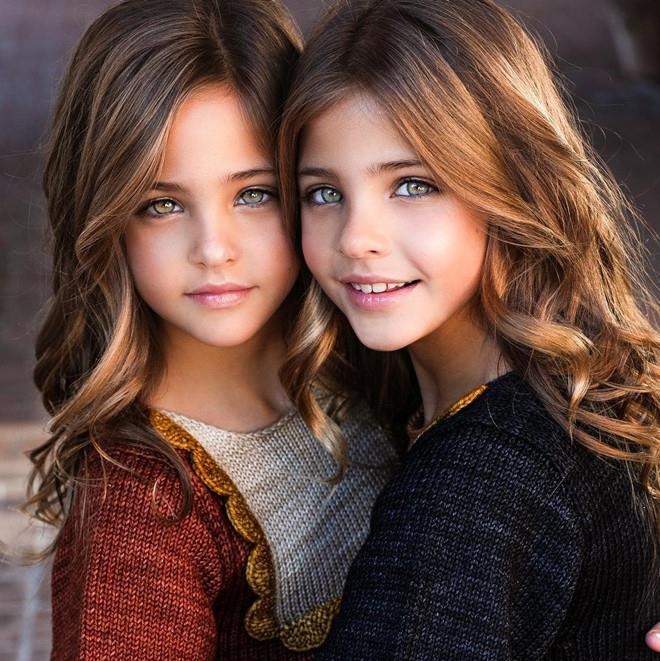 Nhung chi em sinh doi noi tieng the gioi anh 11