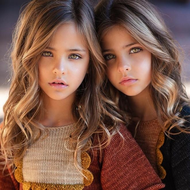 Nhung chi em sinh doi noi tieng the gioi anh 12