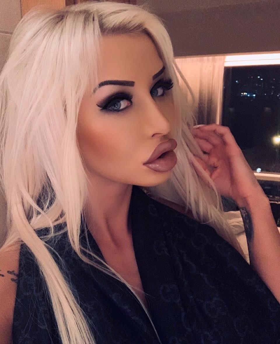 Co gai duoc ban trai cu chi tien phau thuat giong bup be anh 6