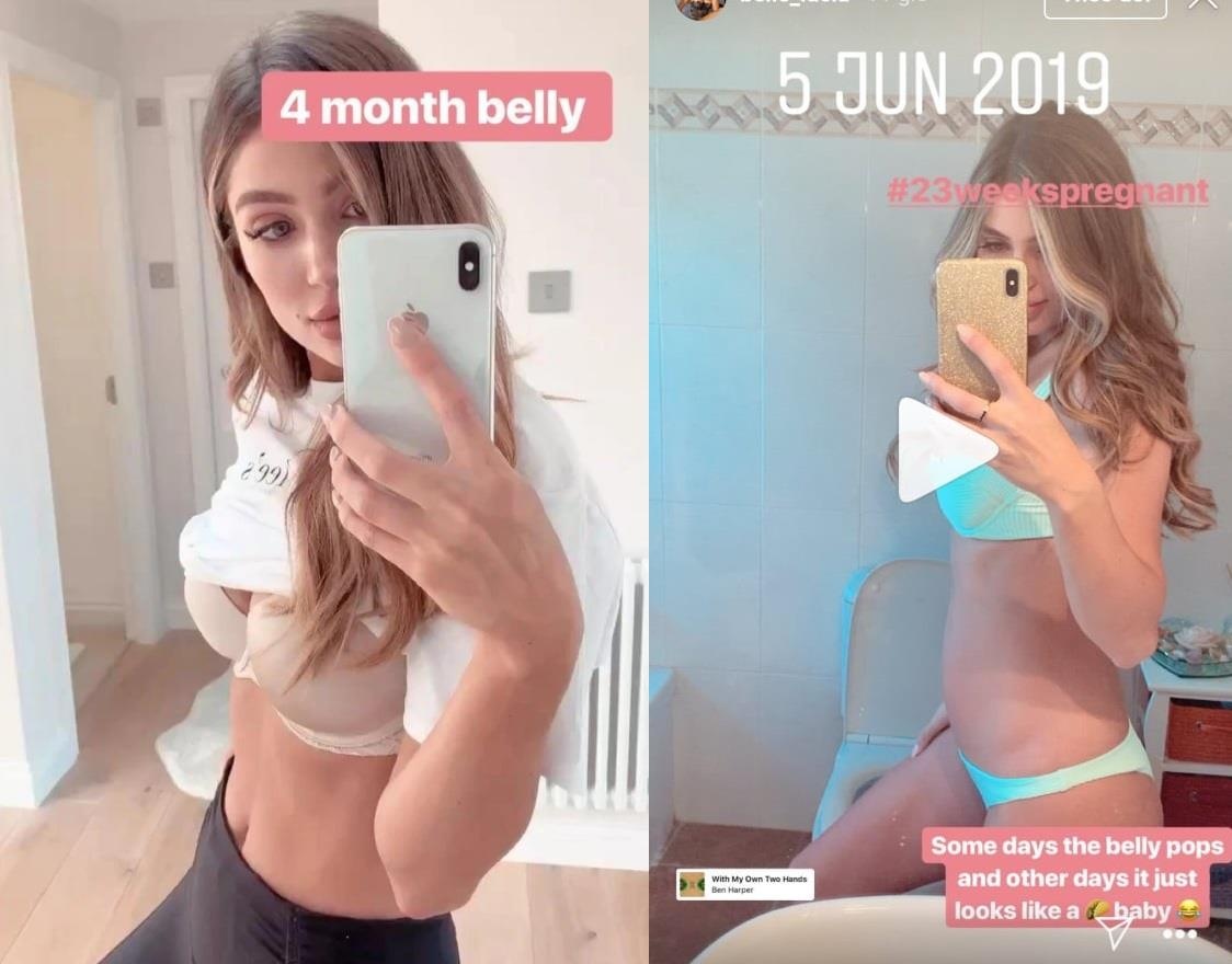 Bung van phang du mang bau 6 thang anh 3