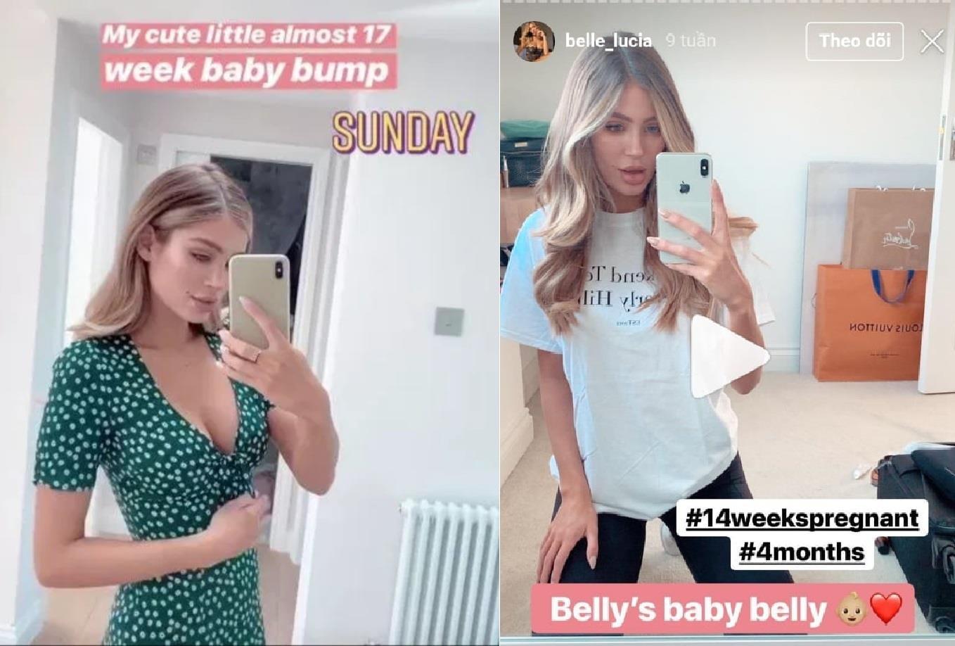 Bung van phang du mang bau 6 thang anh 2