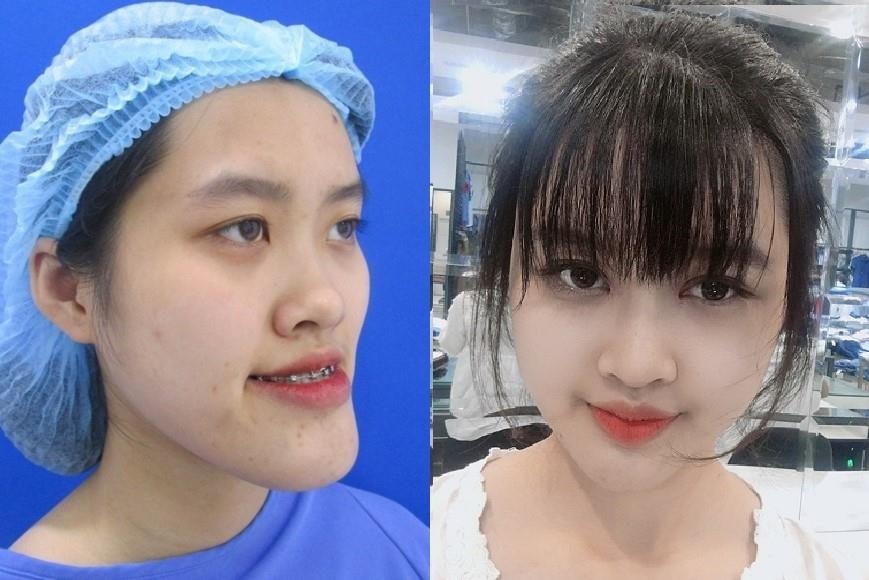 Cô gái bị trêu là mặt rắn ảnh 1 Co gai bi treu la mat ran anh 1