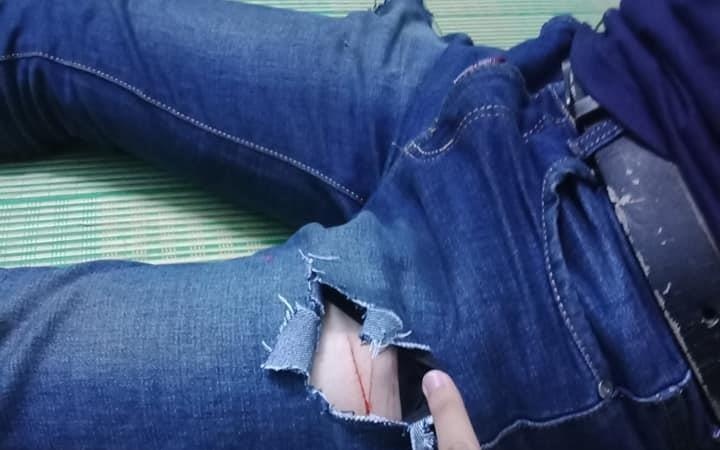 Nam sinh Sai Gon bi con do dung dao lam rach chan cuop tai san hinh anh