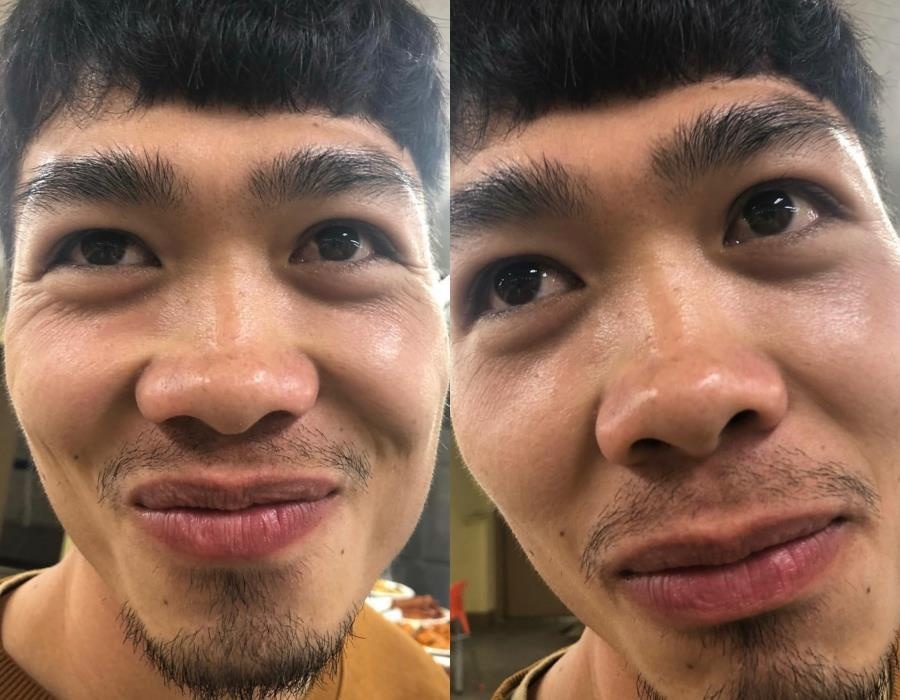 Cong Phuong bi dim hang anh 2