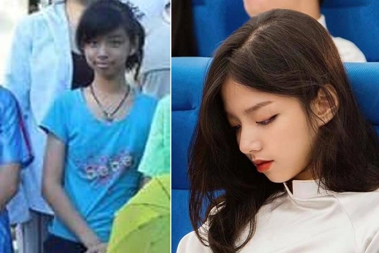 hot girl dậy thì thành công ảnh 1 hot girl day thi thanh cong anh 1