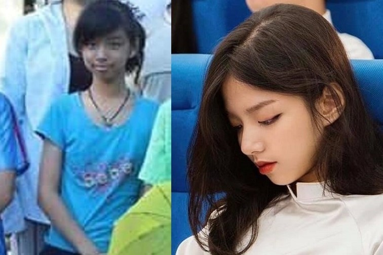 Kien tri nieng rang, 3 co gai thay doi nhan sac hoan toan hinh anh