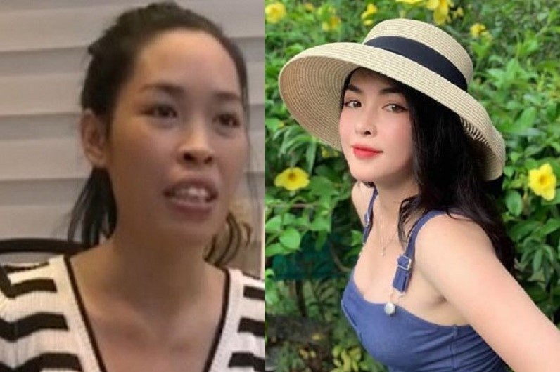 Hot girl phau thuat tham my anh 1