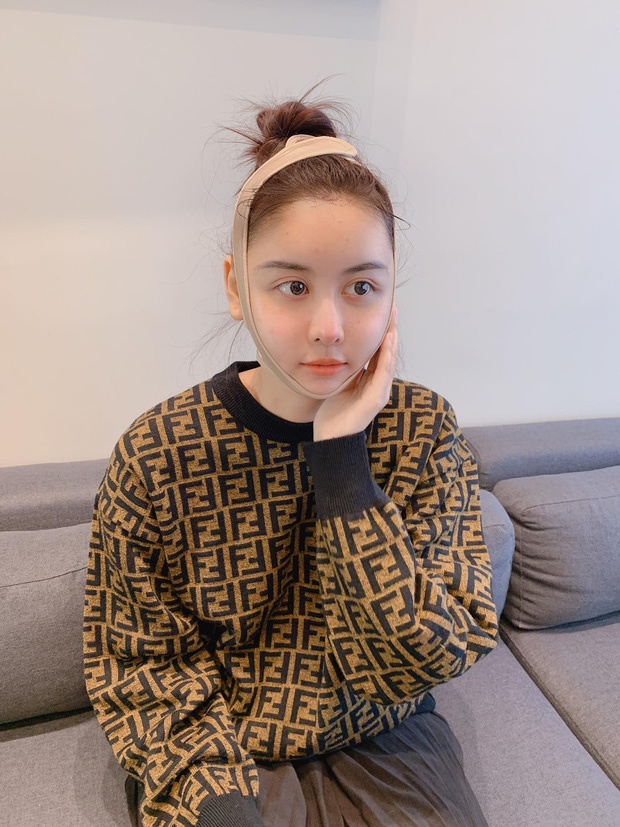 Hot girl phau thuat tham my anh 10