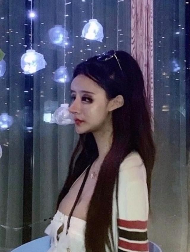 phau thuat tham my anh 2